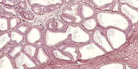 Obraz mikroskopowy gruczołów płciowych dodatkowych