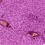 Ostre nieropne limfocytarne rozsiane zapalenie mózgu i rdzenia (encephalomyelitis lymphocytaria disseminata non purulenta acuta)